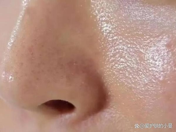 开云kaiyun体育包括平方吃高糖、高脂、高热量的食品-kaiyun体育登陆